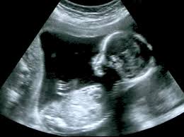 Your little champ weighs about 10 ounces and has a height, crown to rump, of about 6 ½ inches. How Your Baby Is Developing At 20 Weeks