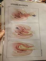 Nursing school taught me when FISTING is actually considered  therapeutic....(X-post from /r/Nursing) : r/WTF