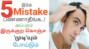 One of the best ways to get results, especially if you are looking for guides on how to stop hair fall immediately — is by increasing collagen intake, and using the mentioned soap above, in. How To Stop Hair Fall For Men Naturally Tips To Control Hair Fall Brottavum Saalnavum Youtube