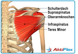 Schulter Op Schulteroperation Vermeiden Schulterhilfe Alternative Nr 1
