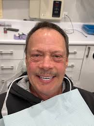 Bionic Smile Full Arch Implants