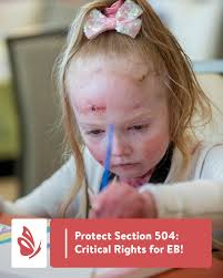 🚨 URGENT: Protect Disability Rights for the EB Community! 🚨 A new lawsuit  is threatening Section 504, a federal law that protects people with  disabilities, including those with EB, by ensuring access