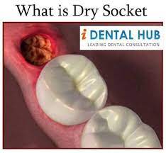 Pin On Dental Care Identalhub