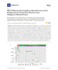, goldblum, j, hart wr. Well Differentiated Papillary Mesothelioma Of The Peritoneum Is Genetically Distinct From Malignant Mesothelioma Raunak Shrestha