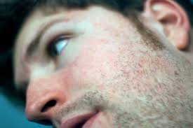 The skin is the largest organ in the body. Signs You Have Skin Cancer