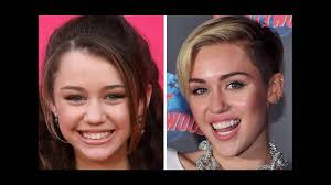 Celebrities like tom cruise, prince harry, angelina jolie, and we found many more, have rocked the braces phase.it's hip to b square!!! Celebrities Before And After Braces Youtube