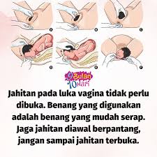 Anda memerlukan alas duduk yang empuk supaya bekas jahitan tidak terasa nyeri. 9bulan10hari Tips Pulihkan Luka Kesan Jahitan Bersalin Facebook