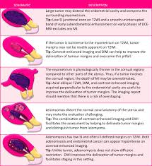 Other signs of uterine cancer Endometrial Cancer Mri Staging Updated Guidelines Of The European Society Of Urogenital Radiology Springerlink