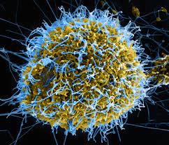 Post Ebola Virus Syndrome Wikipedia