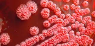 Burkholderia pseudomallei is present in soil and water in the endemic areas, and infection is acquired through skin inoculation or . Scientists Find Mechanism That Leads To Drug Resistance In Bacteria Causing Melioidosis University Of Cambridge
