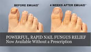 get rid of nail fungus with emuaidmax