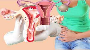 Pin Di Obat Kista