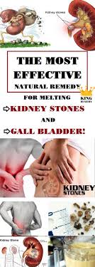 The Most Effective Natural Remedy For Melting Kidney Stones And Gall Bladder King Healthy Life Kidney Stones Gallbladder Kidney Stones Remedy