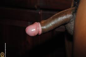 vitiligo naked penis