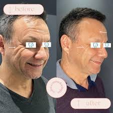 Martin Chapa's Instagram, Twitter & Facebook