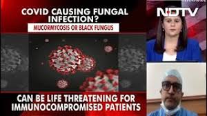 The children were seen in india, where the delta covid variant has ravaged the. Variants Covid Cases With Black Fungus Infection Worry Experts Coronavirus Facts Vs Myths Youtube