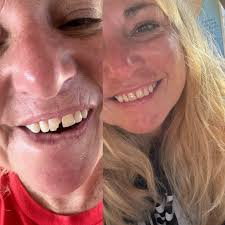 Local dentist office recommendations in Southport