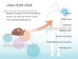 Image result for Lassa Fever