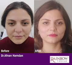 Dr. Afnan Hamdan د....