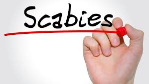 See full list on wikihow.com 7 Most Effective Home Remedies For Scabies Ndtv Food