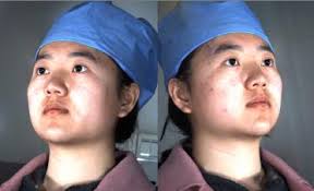 FST-Net: Facial Soft Tissue Landmark Localization