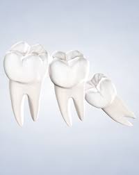 Give area a week to 10 days to heal. Wisdom Teeth Removal In Walnut Creek Ca Third Molar Extraction