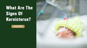 Image result for Kernicterus