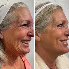 Refresh Central (@refreshcentral) • Instagram photos and videos