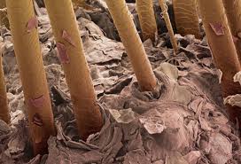 Pictures Thinning Hair Hair Loss In Women
