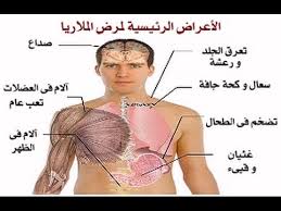 وينتقل مرض الملاريا إلى البشر عن طريق اللدغ من إيناث بعوض الأنوفيل. Ù…Ù† Ø§Ù„Ø­Ù…Ù‰ Ø¥Ù„Ù‰ Ø§Ù„ØºØ«ÙŠØ§Ù† Ø£Ø¹Ø±Ø§Ø¶ Ø§Ù„Ù…Ù„Ø§Ø±ÙŠØ§ ÙˆØ§Ù„Ø£Ø¯ÙˆÙŠØ© Ø§Ù„Ù…Ø¶Ø§Ø¯Ø© Ù„Ù„Ù…Ø±Ø¶ Ø§Ù„ÙˆÙØ¯