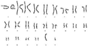 Testing 101 Fast Foundation For Angelman Syndrome