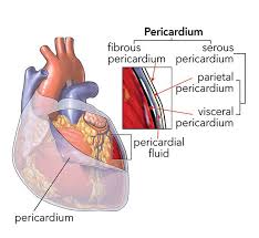 The Pericardium Is A Double Walled Sac That Encloses The Heart Between The Visceral And Parietal Membranes Pericardial Effusion Heart Treatment Heart Anatomy