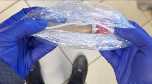 Ciampino, esche per cani e gatti, colpevole una donna 60enne: cosa  rischia – Il Caffe