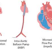 Sublingual Microcirculation in Temporary Mechanical ...