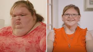 1000-lb Sisters star Tammy Slaton's sisters have shock reaction to her  major skin removal transformation