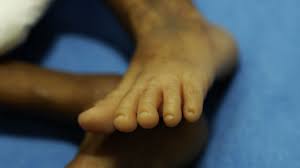 Mali woman gives birth to nine babies. Ycaack667h4iam