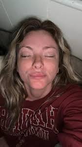 Does Mecca Save Face sunscreen cause breakouts?