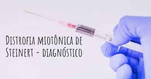 Duchenne, becker y otras 47 trastornos miotónicos: Qual E A Esperanca De Vida Com Distrofia Miotonica De Steinert