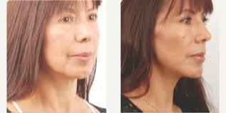 Kenneth K. Kim, MD, Board Certified Plastic Surgeon