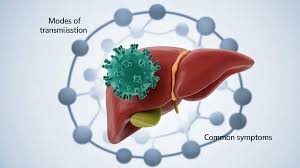 Image result for hepatitis symptoms