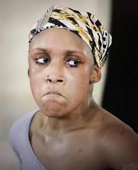 concern about friend's skin health