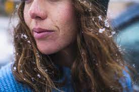 Despite your best efforts, some of your plants still might suffer from sunburn or windburn, causing scorch marks that can vary in color from brown to tan to white. How To Treat Wind Burn On Face And Stop It From Happening Again Self