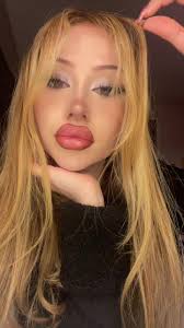 I burned my sweater 🙃