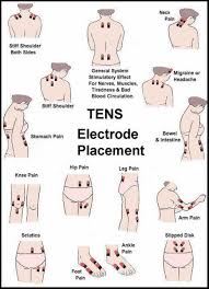 Pin On Medical