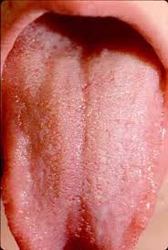 Image result for Filiform Papillae
