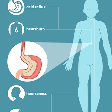 Smoking and obesity increase a. Gerd Signs Symptoms And Complications