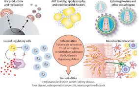 Image result for AIDS-Defining Illness