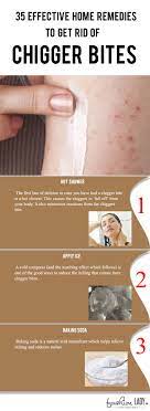 Pin On Home Remedies