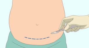 How do we get our metabolisms and reproductive systems back on track? How To Recognize The Symptoms Of Polycystic Ovary Syndrome