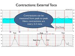 Qcom Fetal Heart Monitoring Uterine Contractions